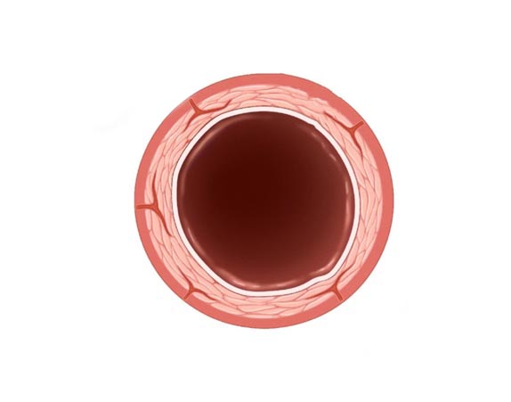 angiologie gefässkrankheiten arterien