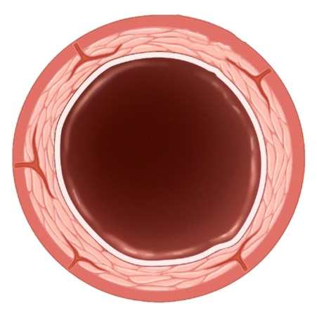 angiologie gefässkrankheiten arterien